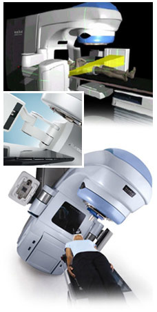 Collage of external beam machine photos