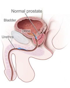Illustration of normal prostate